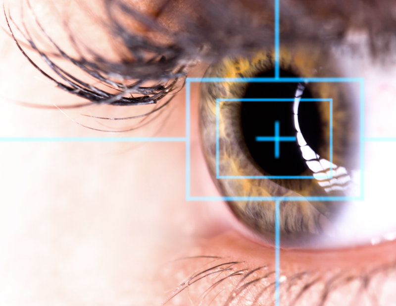 8 criteria for a good lasik candidate