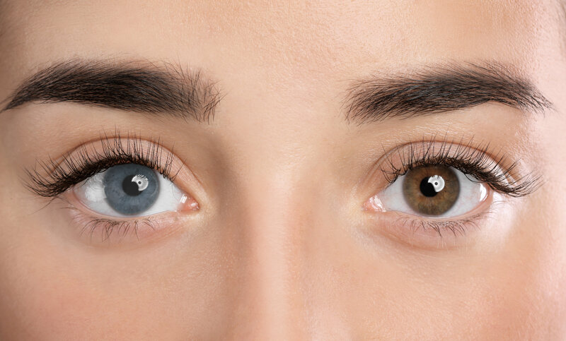 what is heterochromia