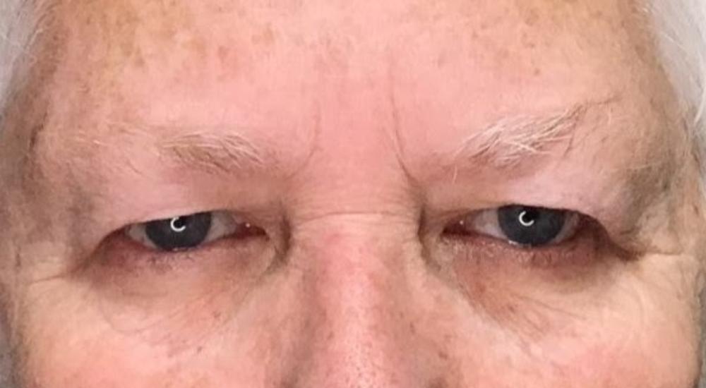Before image