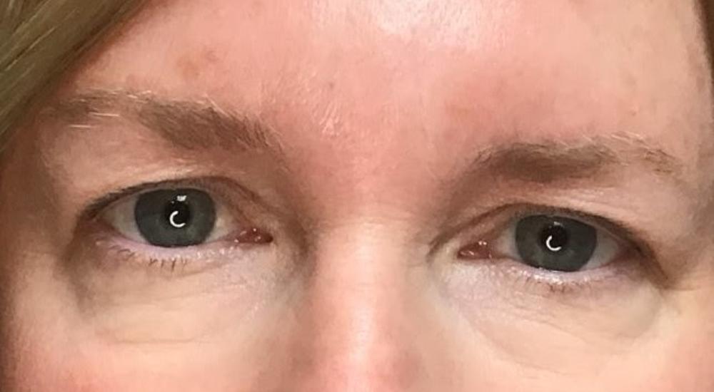 Before image