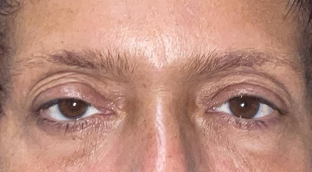 Before image